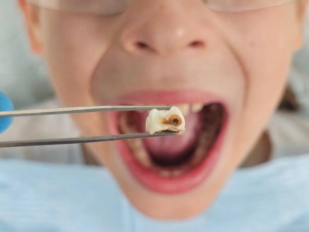 Best Emergency Tooth Extraction  in Bloomingburg, OH
